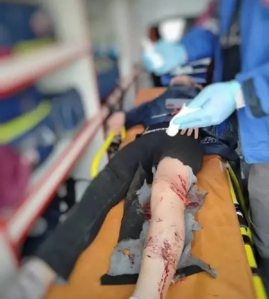 Двое мальчиков 12 и 13 лет пострадали после нападения бродячих собак у мемориалов на горе Шмидта. Один из подростков получил серьёзные травмы, пострадавших доставили в больницу. Прокуратура выясняет обстоятельства и оценит работу ответственных.